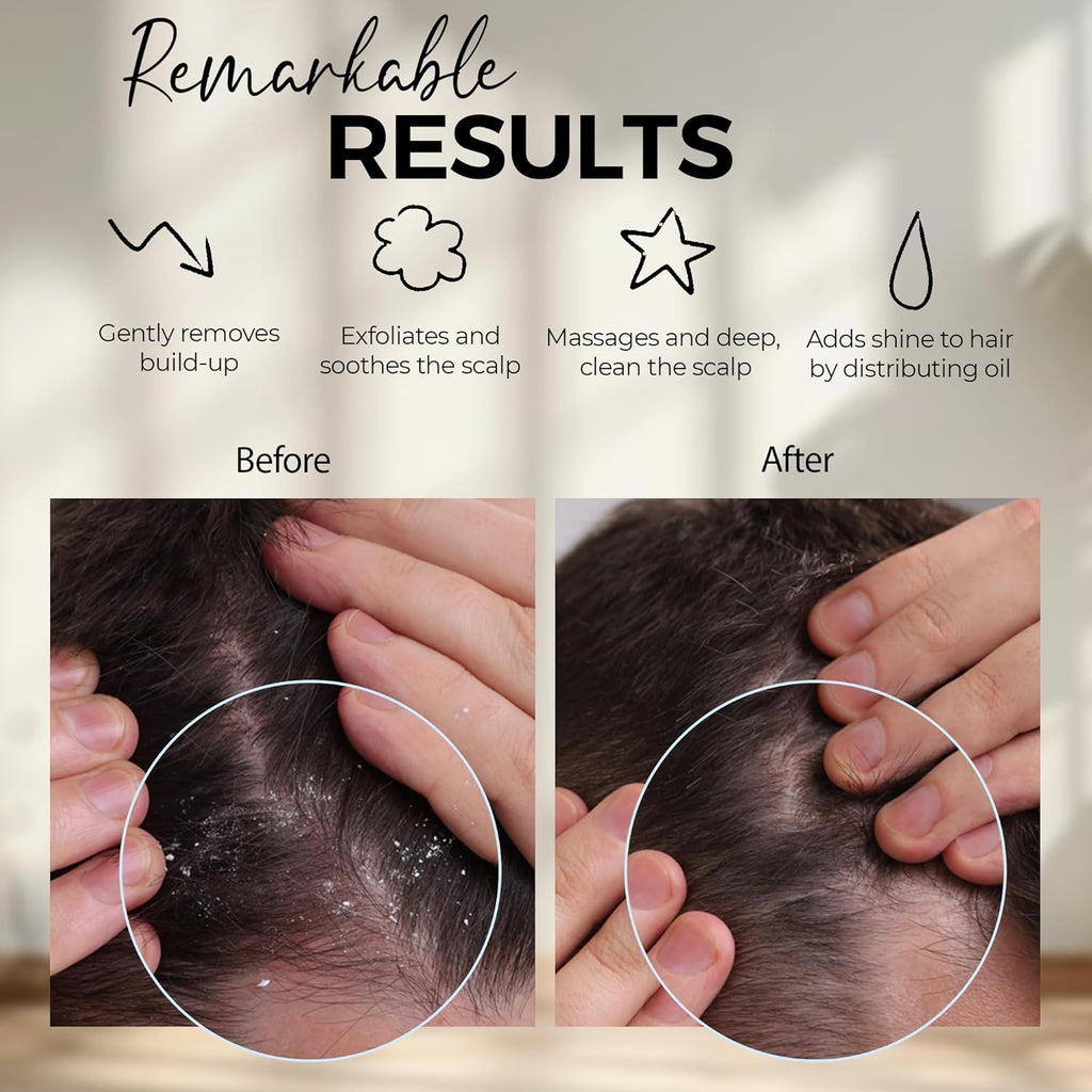 Scalp Massager Shampoo Brush